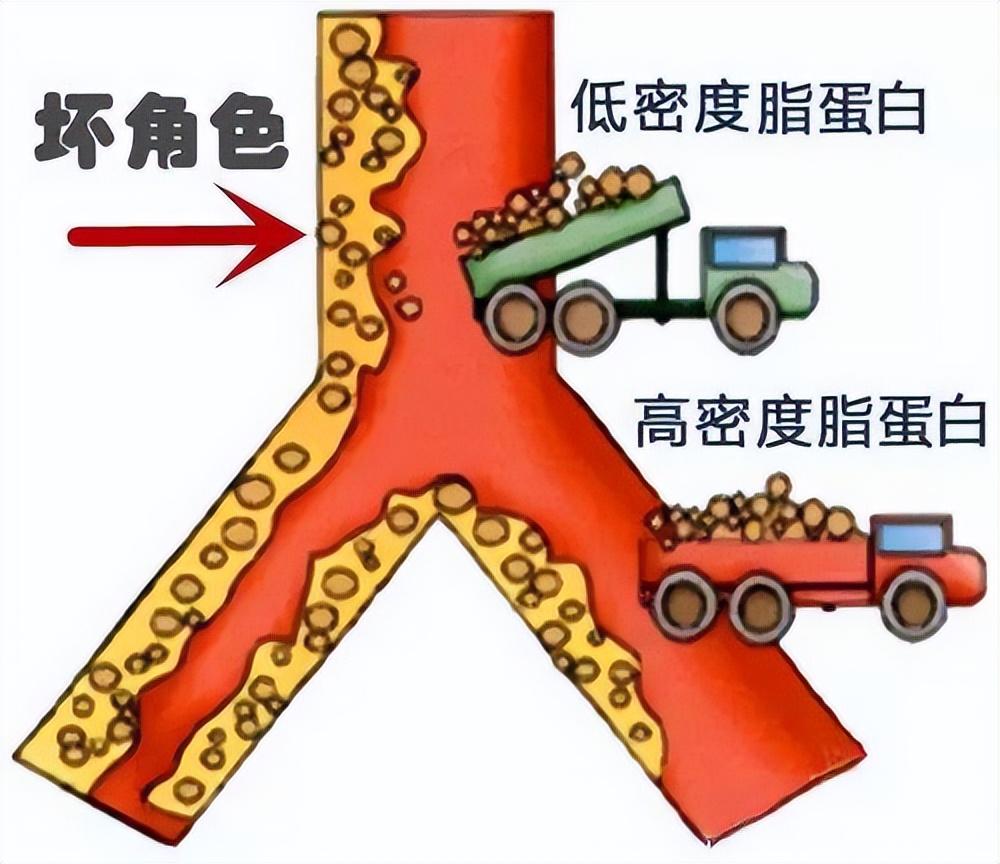 体检完血脂高就要吃药吗（降低血脂精选7个方法）