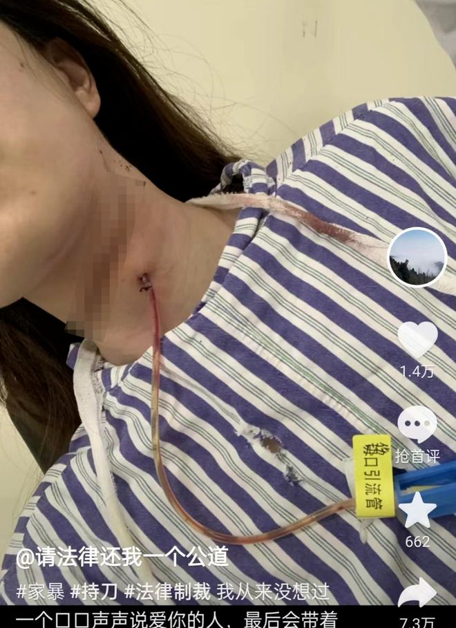 女子被家暴割喉 丈夫被拘留10天（背后的真相是什么）