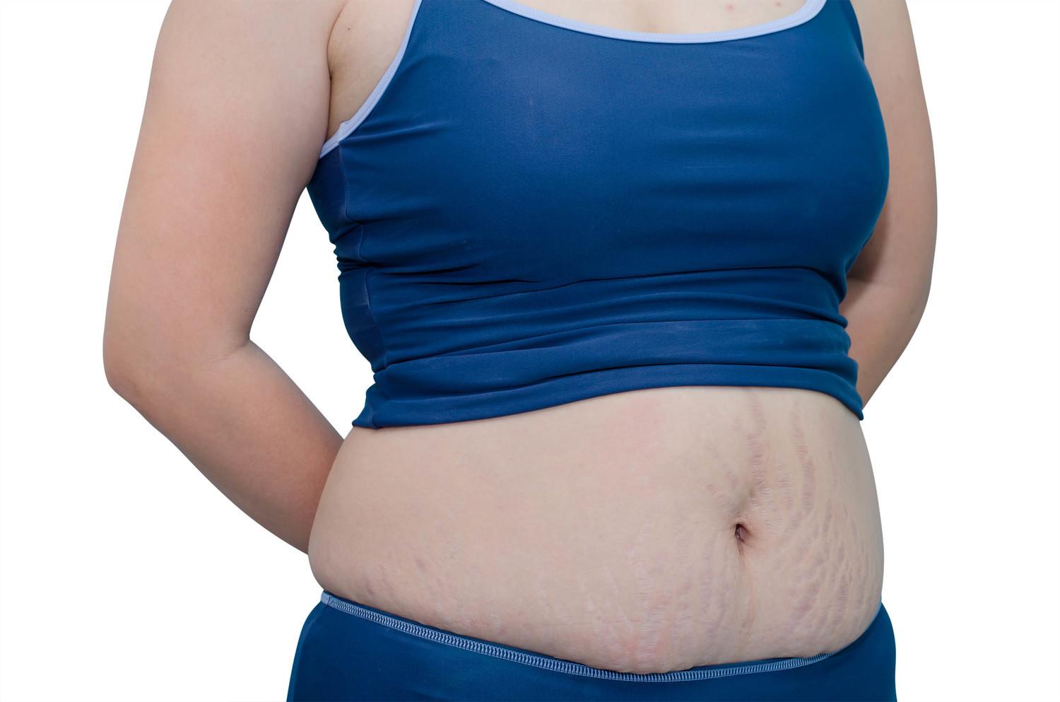 女生腰围77cm粗还是细（教你缩小腰围的六种方法）