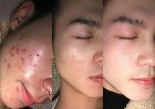 男生怎么变帅简单方法（提升男生颜值的小细节）